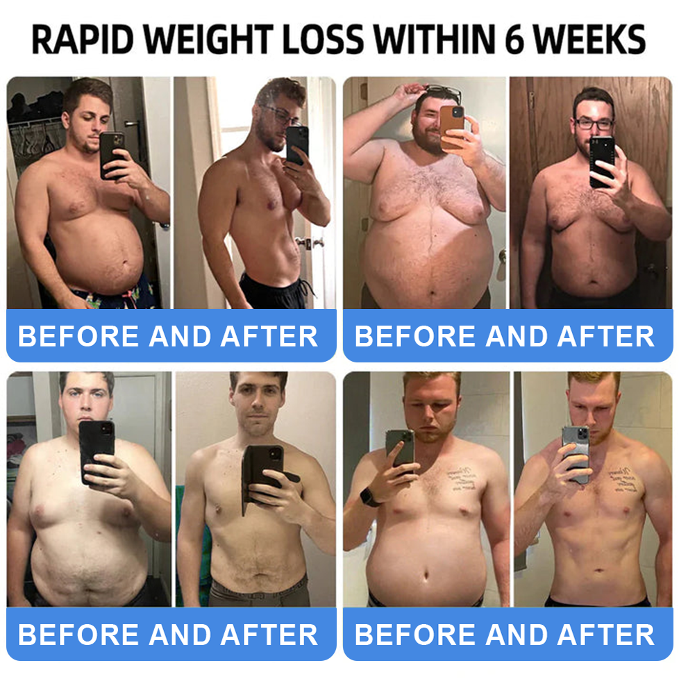 【Last Day Promotion 66% OFF🥇】 𝑪𝒗𝒓𝒆𝒐𝒛® GLP-1-Tirzepatide Oral Solution 🇺🇸visible effect, no side 7 days effects, suitable for all age groups 🏪