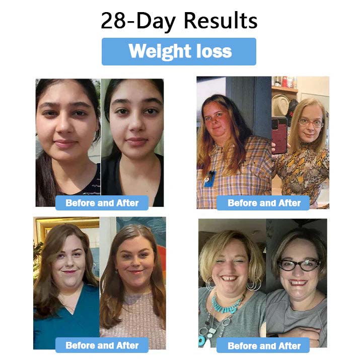 Last day 50% off promotion ✅【𝐋𝐦𝐢𝐩𝐤𝐢 𝐎𝐟𝐟𝐢𝐜𝐢𝐚𝐥 𝐒𝐭𝐨𝐫𝐞】🇺🇸 𝖫𝗆𝗂𝗉𝗄𝗂®  𝖭𝖨𝖣𝖣𝖪-𝖳𝗂𝗋𝗓𝖾𝗉𝖺𝗍𝗂𝖽𝖾 𝖭𝖺𝗇𝗈 𝖬𝗂𝖼𝗋𝗈𝗇𝖾𝖾𝖽𝗅𝖾 𝖯𝖺𝗍𝖼𝗁 （𝖹𝖾𝗋𝗈 𝖯𝖺𝗂𝗇, 𝟤𝟦/𝟩 𝖱𝖾𝗅𝖾𝖺𝗌𝖾 | 𝖫𝗈𝗌𝖾 𝟤𝟢𝗅𝖻𝗌 𝖥𝖠𝖲𝖳 | 𝟫𝟢% 𝖲𝗎𝗀𝖺𝗋 𝖣𝗋𝗈𝗉 ）