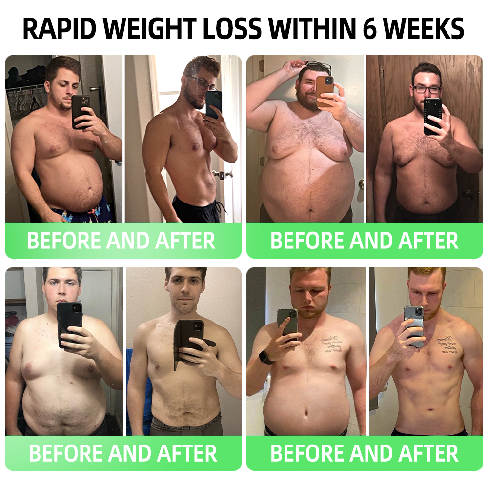 𝗟𝗺𝗶𝗽𝗸𝗶® 👨‍⚕️ Nano Microneedle Patch with SMGT-GLP-1 & Matrixyl 3000 – Slimming, Skin Tightening, Blood Sugar Support, No Injection, 7-Day Result