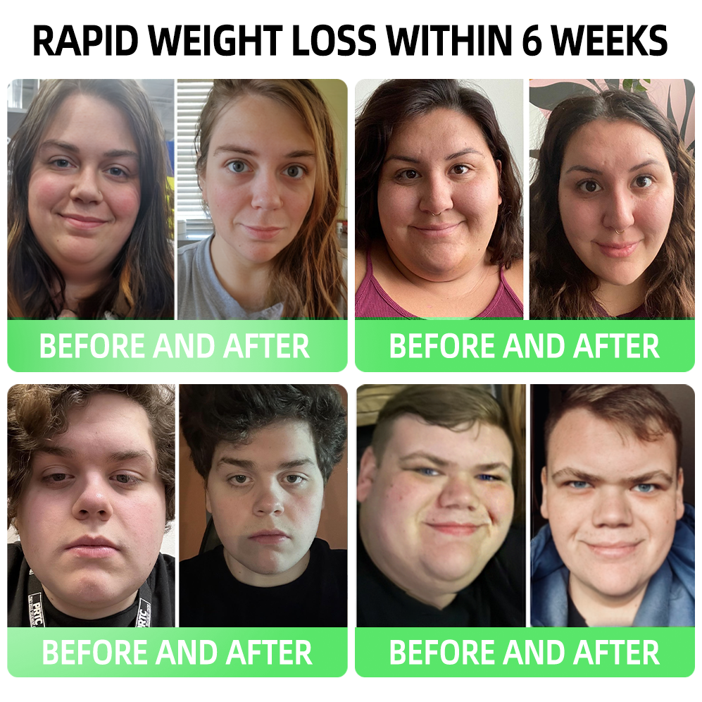 𝗟𝗺𝗶𝗽𝗸𝗶® 👨‍⚕️ Nano Microneedle Patch with SMGT-GLP-1 & Matrixyl 3000 – Slimming, Skin Tightening, Blood Sugar Support, No Injection, 7-Day Result