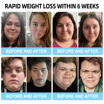 Last day 50% off promotion ✅【𝐋𝐦𝐢𝐩𝐤𝐢 𝐎𝐟𝐟𝐢𝐜𝐢𝐚𝐥 𝐒𝐭𝐨𝐫𝐞】🇺🇸 𝖫𝗆𝗂𝗉𝗄𝗂®  𝖭𝖨𝖣𝖣𝖪-𝖳𝗂𝗋𝗓𝖾𝗉𝖺𝗍𝗂𝖽𝖾 𝖭𝖺𝗇𝗈 𝖬𝗂𝖼𝗋𝗈𝗇𝖾𝖾𝖽𝗅𝖾 𝖯𝖺𝗍𝖼𝗁 （𝖹𝖾𝗋𝗈 𝖯𝖺𝗂𝗇, 𝟤𝟦/𝟩 𝖱𝖾𝗅𝖾𝖺𝗌𝖾 | 𝖫𝗈𝗌𝖾 𝟤𝟢𝗅𝖻𝗌 𝖥𝖠𝖲𝖳 | 𝟫𝟢% 𝖲𝗎𝗀𝖺𝗋 𝖣𝗋𝗈𝗉 ）