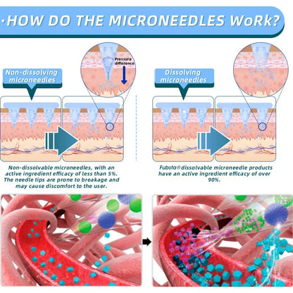 Last day 50% off promotion ✅【𝐋𝐦𝐢𝐩𝐤𝐢 𝐎𝐟𝐟𝐢𝐜𝐢𝐚𝐥 𝐒𝐭𝐨𝐫𝐞】🇺🇸 𝖫𝗆𝗂𝗉𝗄𝗂®  𝖭𝖨𝖣𝖣𝖪-𝖳𝗂𝗋𝗓𝖾𝗉𝖺𝗍𝗂𝖽𝖾 𝖭𝖺𝗇𝗈 𝖬𝗂𝖼𝗋𝗈𝗇𝖾𝖾𝖽𝗅𝖾 𝖯𝖺𝗍𝖼𝗁 （𝖹𝖾𝗋𝗈 𝖯𝖺𝗂𝗇, 𝟤𝟦/𝟩 𝖱𝖾𝗅𝖾𝖺𝗌𝖾 | 𝖫𝗈𝗌𝖾 𝟤𝟢𝗅𝖻𝗌 𝖥𝖠𝖲𝖳 | 𝟫𝟢% 𝖲𝗎𝗀𝖺𝗋 𝖣𝗋𝗈𝗉 ）